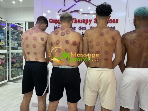 hijama-cupping-therapy-services-big-2