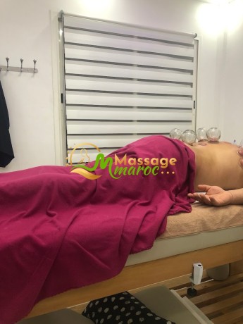 hijama-cupping-therapy-services-big-1